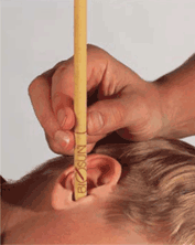 EAR CANDLING 1